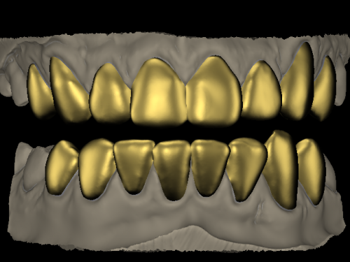 CLASSIC GRILLZ